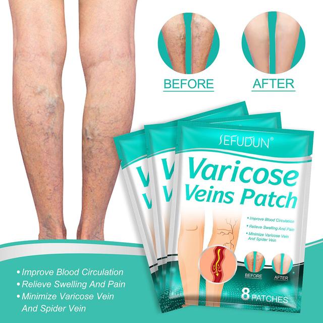 Yizhilaiqian Sefudun Vein Plaster Red Blood Silk Repair Earthworm Leg Green Tendon Bulge Relieve Pain Safflower Cream Nursing Adhesive Bandage 8 Pi... on Productcaster.