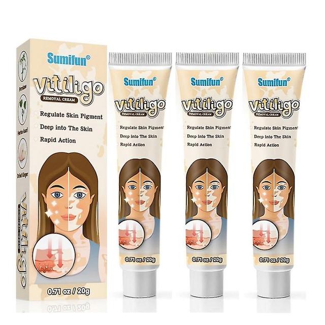 3pcs Herbal Extract Vitiligo Ointment Remove Ringworm White Spot Removal Skin Vitiligo Eliminate Vitiligo Treatment Cream on Productcaster.