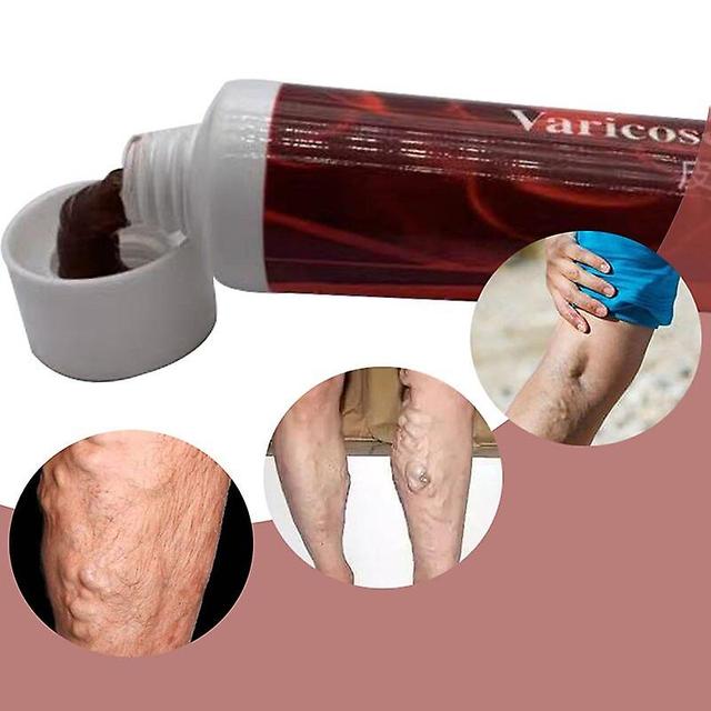 Coscelia New Varicose Vein Ointment Vein Removal Balm Cream Varicose Veins Legs Spider Veins Removal Legs Chinese Herbal 20g on Productcaster.