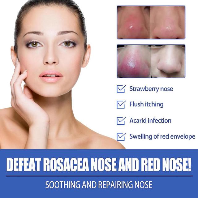 Rosacea Remover Siero Naso Rosso Trattamento Liquido Rimuovere Punti Neri Riparazione Acne Segno Arrossamento Strizzacervelli Por on Productcaster.