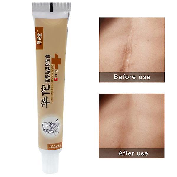 20g Lithospermum Burn Scald Skin Repair Hua Tuo Antibacterial Cream on Productcaster.