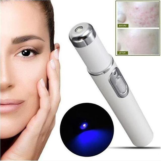 Guoguo Spider Vein Eraser Blue Light Therapy Wrinkle Acne Laser Pen Soft Scar Removal on Productcaster.