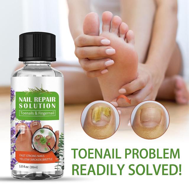 steamwindway Tea tree oil toenail fungus treatment liquid for damaged nails - renewal nail repair solution 3pcs - 90ml on Productcaster.