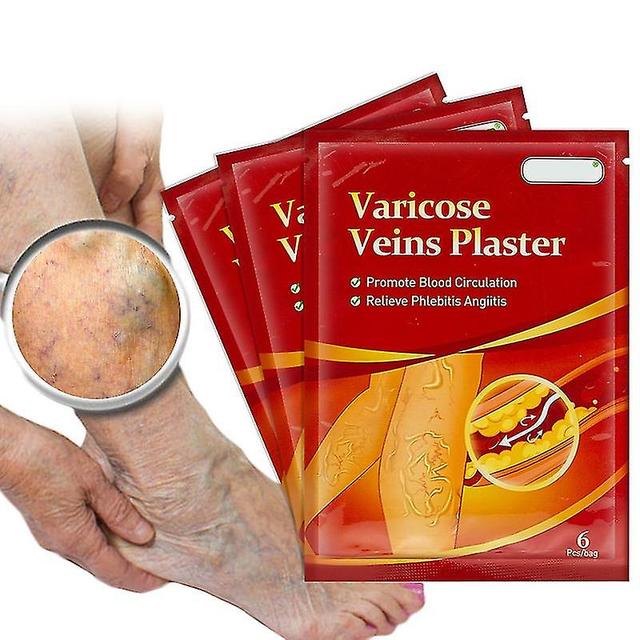 Duqi Varicose Veins Patch Relieve Pain Vasculitis Repair Earthworm Legs Spider Legs Veins Bulge Improve Blood Circulation Health Care on Productcaster.