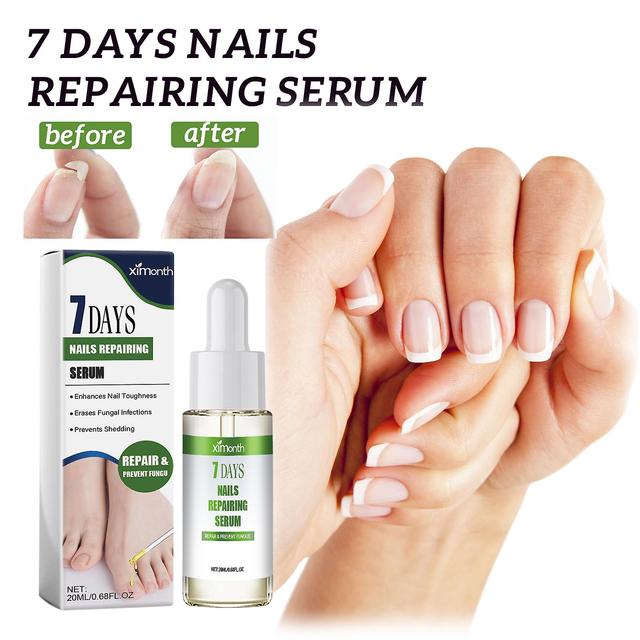 Chicoque 7 Days Nail Growth and Strengthening Serum, Nail Growth & Strengthening Oil Serum, Nail Serum for Growth and Strength 20ml-1pc on Productcaster.