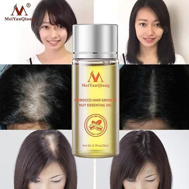 Fast Powerful Hair Growth Essence Hair Loss Products Essential Oil Liquid Treatment Preventing Hair Loss Hair Care Products 20ml 5pcs on Productcaster.