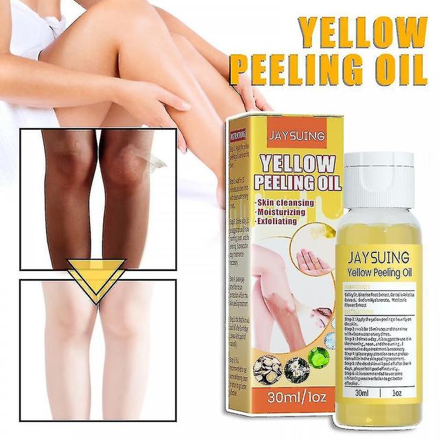 Peeling Oil Super Strength Yellow Peeling Oil Super Strength Yellow Peeling Oil Lightening on Productcaster.