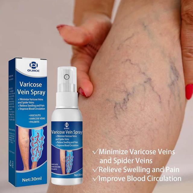 Finiss 30ml Varicose Vein Sprayvein Healing Varicose Vein Spray For Legs Minimize Spider Veins Relieve Swelling Improve Circulation on Productcaster.