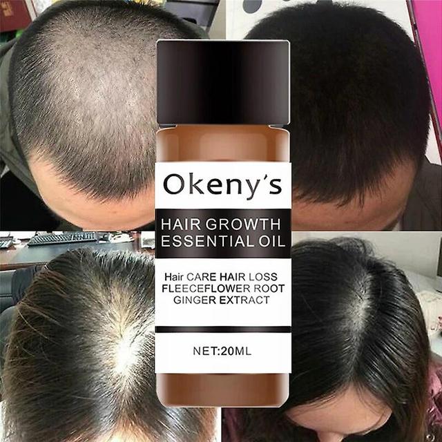 Okeny's Fast Powerful Hair Growth Essence Products Essential Oil Liquid Treatment Preventing Hair Loss Hair Care Andrea 20mlHair Loss Treatments on Productcaster.