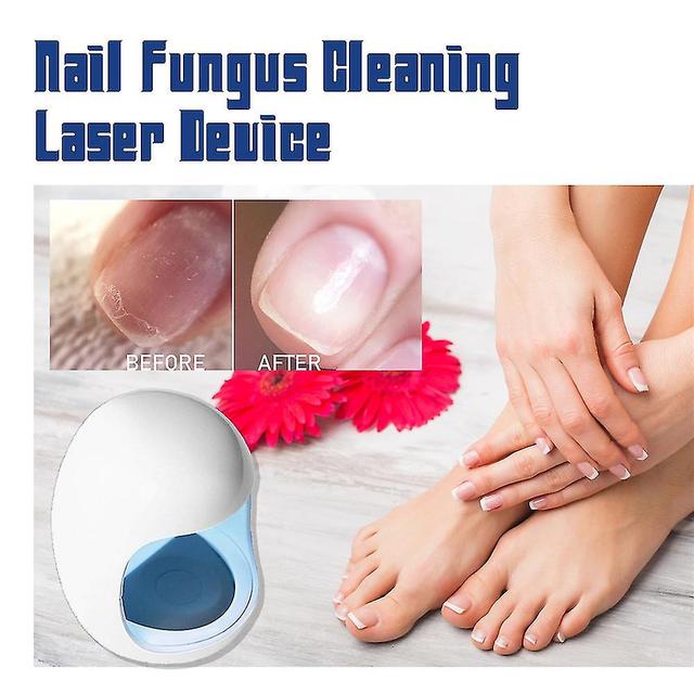 Aoui Fungal Nail Laser Device Repair Fast Nails Fungus Onychomycosis on Productcaster.