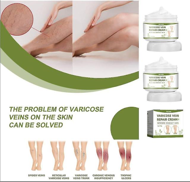 Mlsilm 2pcs Eelhoe Vein Repair Cream Massage Les jambes Pour soulager la douleur et draguer Le méridien et les veines Soins de relaxation on Productcaster.