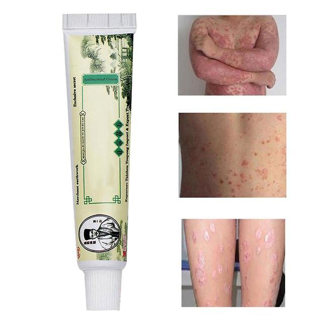 Shenmo 15g Chinese Herbal Psoriasis Skin Care Dermatitis Eczema Pruritus Psoriasis Cream Ointment on Productcaster.