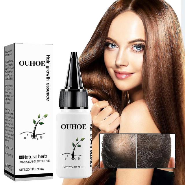 1/2/3pcs Hair Growth Essence Advanced Thinning Hair & Hair Loss Supplement 1PCS 20ml on Productcaster.