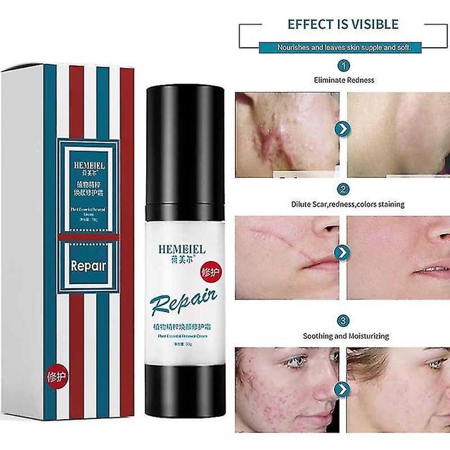 Buy 1 Get 1 Freewomen Skin Repair Cream Herb Essence Scars Marks Remover Cream Moisturizing on Productcaster.