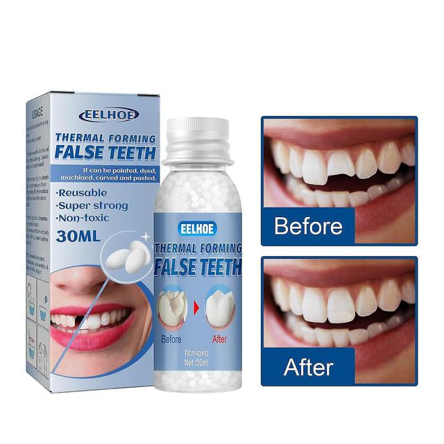 Tooth Repair Granules, Temporary Filling For Rooth, Broken Tooth Repair, Teeth Beads, Thermal Fitting Beads (30ml) on Productcaster.