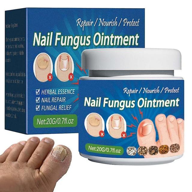 Sweet Restorative Ointment For Nails, Pareo Cream, Onychomycosis, Natural Feet Treatment, Suitable For Damage And Discolored, 20g, N64. on Productcaster.