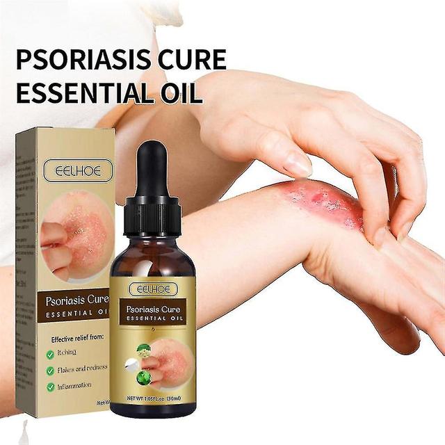 celebrate success New Psoriasis Essential Oil Relieves Itching, Burning, Redness, Powerful Mild Herbal, 100% Natural I on Productcaster.