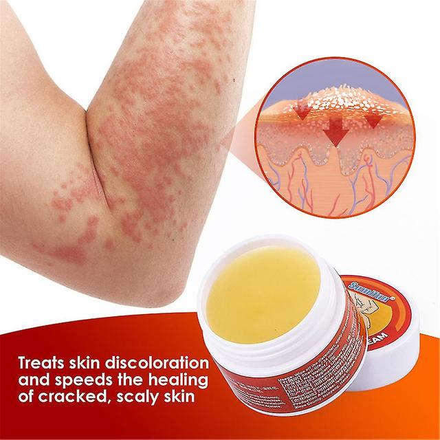 10g Herbal Psoriasis Cream Joint Knee Neck Shoulder Care Cream 1PCS on Productcaster.