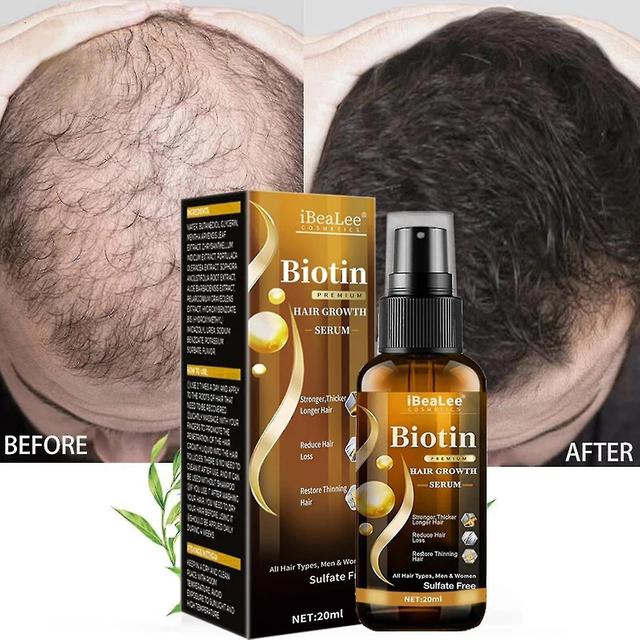 Ginger Serum,natural Anti Baldness Biotin Fast Growing Oil on Productcaster.