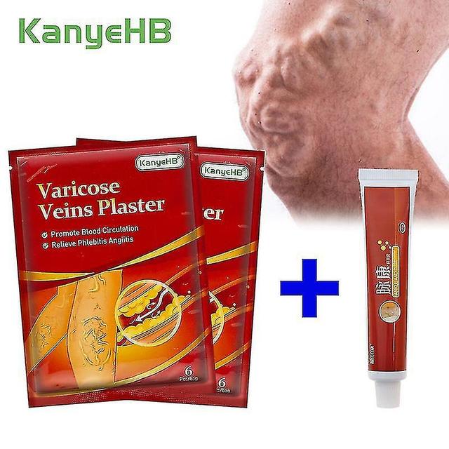 christina show 12pcs Varicosity Plaster+1pcs Varizes Ointmnet Vasculite Phlebitis Cream Angiitis Remoção Ele on Productcaster.