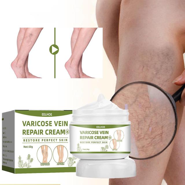 Eelhoe Varicose Vein Repair Cream Tongmai Relieves Leg Varicose Vein Pain Relief Earthworm Leg Pain Red Blood Silk Spider Leg Xinmu on Productcaster.