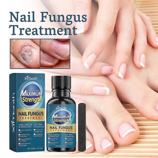 Extra Strength Toenail Fungus Treatment with Natural Tea Tree Oil Extract 2pcs on Productcaster.