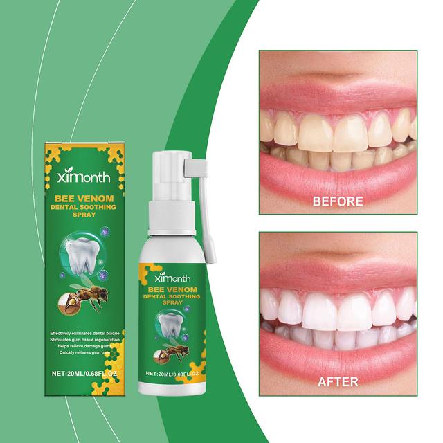 Wtowin Bee Venom Dental Soothing Spray, Propolis Oral Health Spray, Propolis Teeth Cleaning Spray, Propolis Natural Dental Soothing Spray 2pcs on Productcaster.