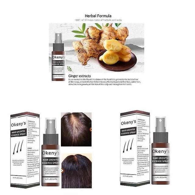 Ginger Hair Growth Essence Spray 20ml Hair Grow Restoration Oil Prevent Baldness on Productcaster.