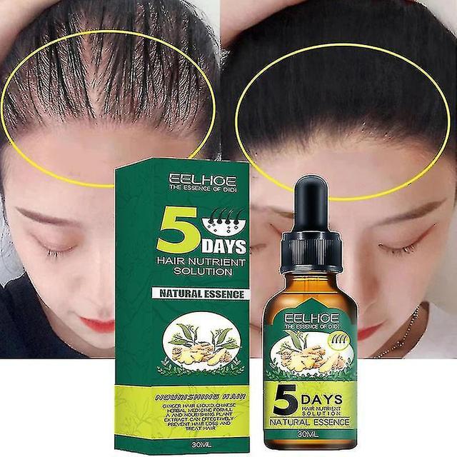 christina show 5 Days Hair Growth Essential Oil Ginger Fast Growing Hair Essential Oil Beauty Hair Care Prevent Hai on Productcaster.