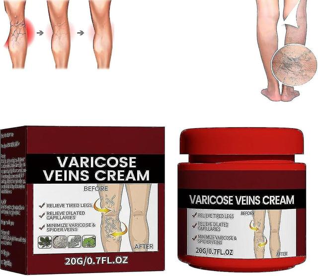 Cream Varicose Veins, Varicose Veins Treatment For Legs, Varicose Vein & Soothing Leg Cream Strengthen Capillary Health Reduces Spider Veins 1pcs on Productcaster.