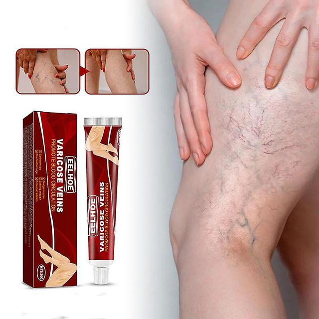 Face Effektive urter creme til åreknuder, vaskulitis, flebitis, edderkop, institutter, salve, gips af urter, skønhed, kropspleje Buy 80g Get 100g on Productcaster.