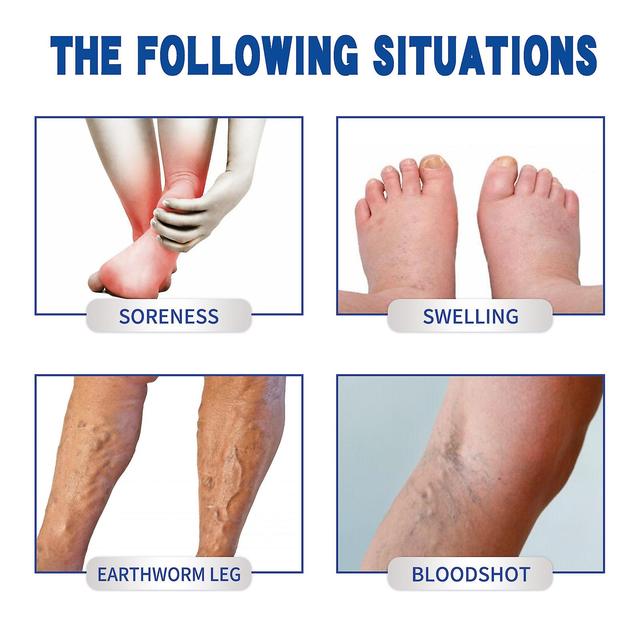 Venous Soothing Cream Reduce Spider Veins, Smooth Vein and Varicocele, Relieve Swelling and PainC5 on Productcaster.