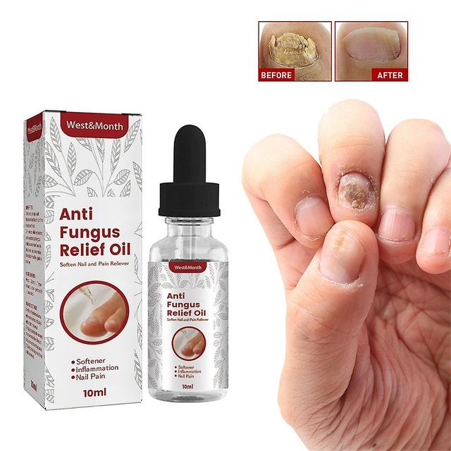 Onychomycosis Oil Recover Nail Treatment Health Toenail Rapid Relief Treatment on Productcaster.