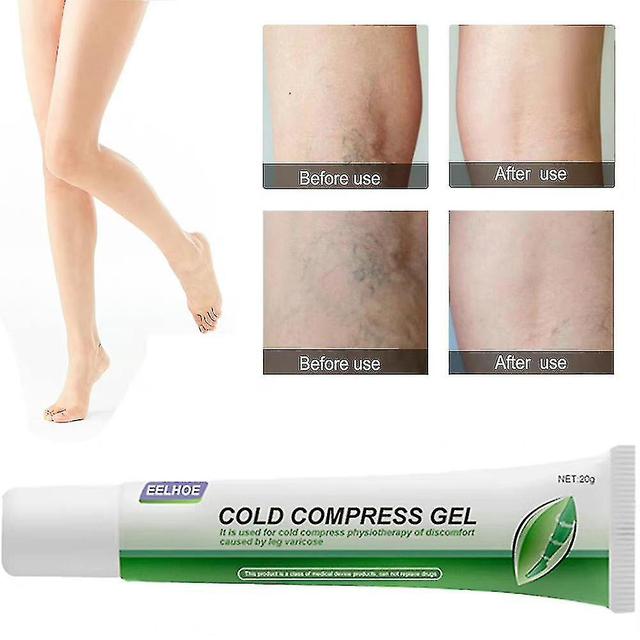 2szt 20g Żylaki Żel do nóg Popraw krążenie krwi Cold Compress Gel on Productcaster.