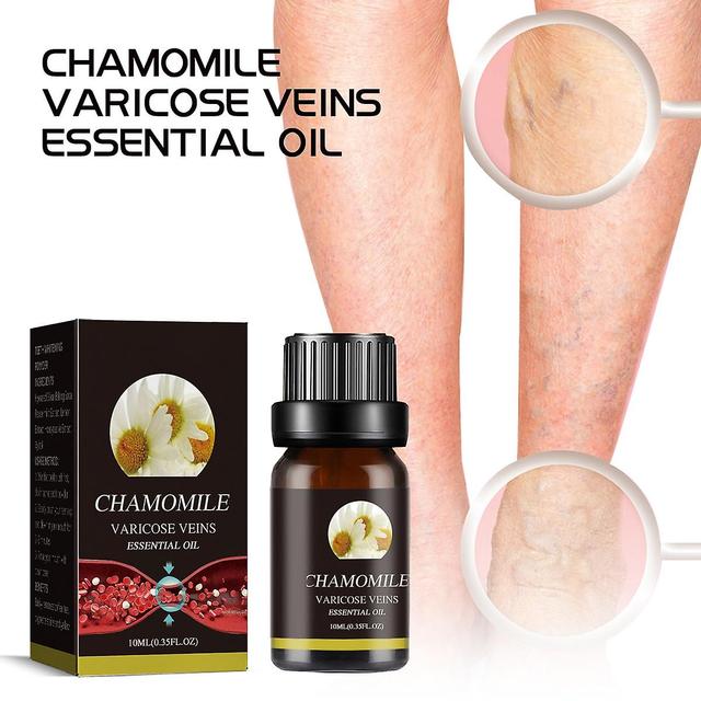 Mamusk Varicose Veins Essential Oil, Chamomile Oil Varicose Veins, Chamomile Essential Oil For Varicose Veins, For Skin 2Pcs on Productcaster.