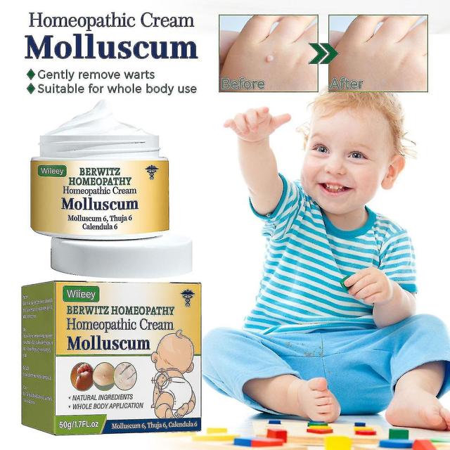 Molluscum Wratten Homeopathie Crème & Remedie Granules Kit - Veilige en effectieve behandeling voor baby's, kinderen en volwassenen 5pcs on Productcaster.