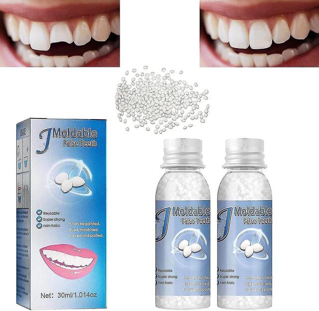 Moldable False Teeth Tooth Repair Granules, Teeth Repair Kit, Diy Temporary Tooth Repair Beads Broke on Productcaster.