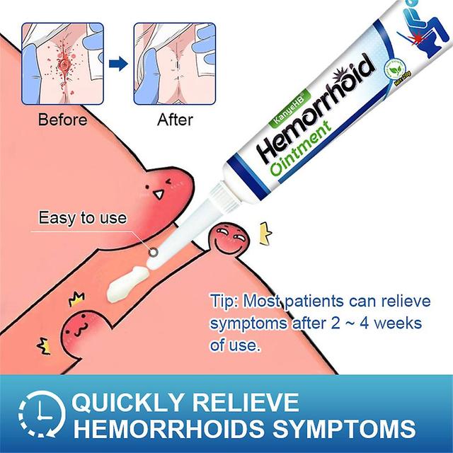 Hemorrhoids Internal And External Anal Fissure Cream Pain Reliving Cooling Herbs on Productcaster.