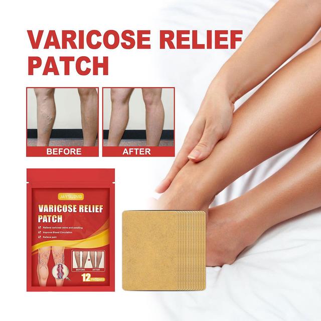 Gaoguang Varicose Veins Patch,Spider Vein Legs Spider Vein Edema Neuralgia Leg Pain Vasculitis Promotes Circulation 240862 Multicolor on Productcaster.