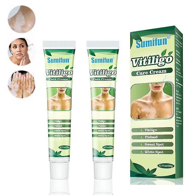 2pcs Herbal Extract Vitiligo Ointment Remove Ringworm White Spot Removal Skin Vitiligo Eliminate Vitiligo Treatment Cream on Productcaster.