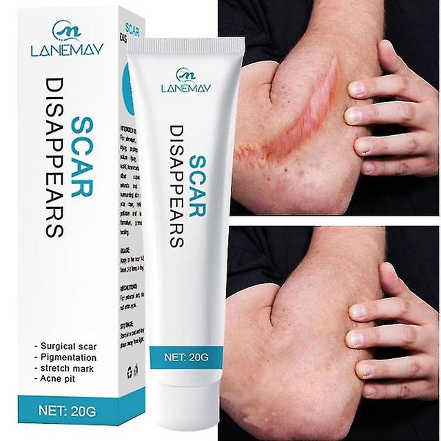 Stretch Marks Burns Acne Surgery Acne Scars Creams Cold Gels on Productcaster.