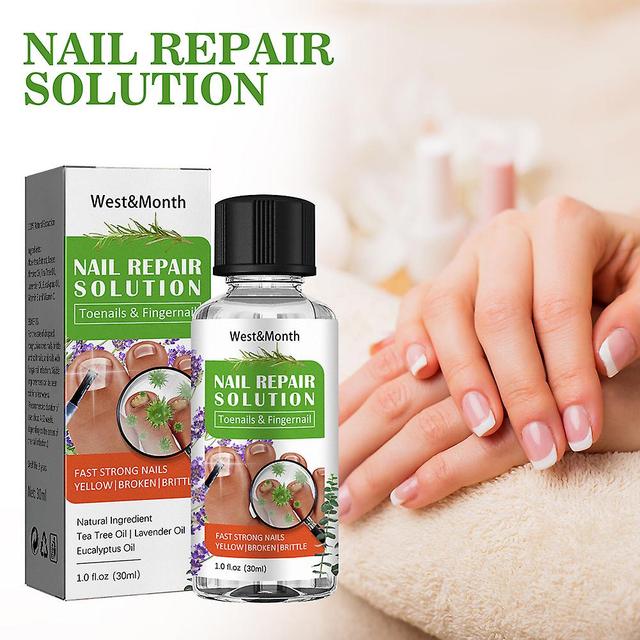 Antifungal Treatment Liquid 30ml, Anti-infection Effective Oil For Toes, Antibacterial Essence For Multiple Uses For Feet Care on Productcaster.