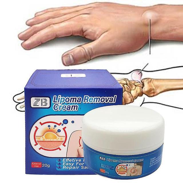 Lipoma Removal Cream Drug Herbs Medical Plaster Multiple Anti-tumor Peeling Fat Mass Remove Pain on Productcaster.