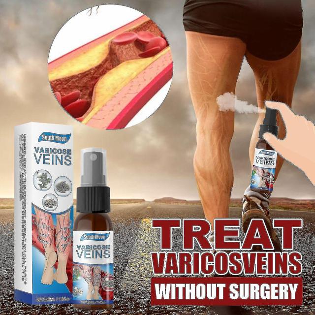 Vein Massage Varicose Active Spray To Smooth Blood Vessel Bulge Smooth Earthworm Leg Leg Massage 30ml on Productcaster.