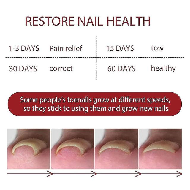 1pc Anti Paronychia Relief Oil, Ingrown Toenail Treatment, Nail Renewal Liquid For Damaged Discoloration Nail#d711856 on Productcaster.