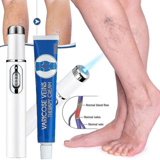 Blue Light Therapy Pen For Varicose Veins Therapy Wrinkle Acne Laser Pen-color:varicose Veins Cream on Productcaster.