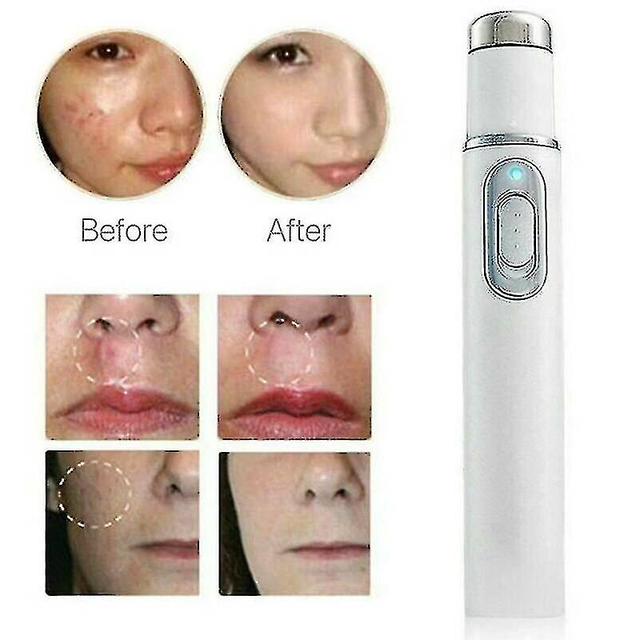 Spider Vein Eraser Blue Light Removal Eraser Therapy Wrinkle Acne Laser Pen Scar Redmiter@ on Productcaster.