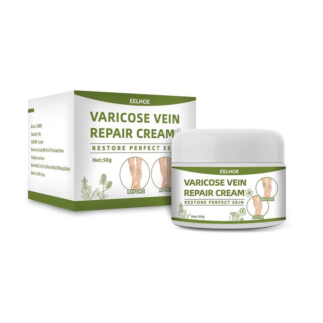 Flye Varicose Vein Cream 50g Varicose Vein Cream Anti-spider Veins And Spider Vein Removal Varicose Veins Leg Care Ointment White on Productcaster.