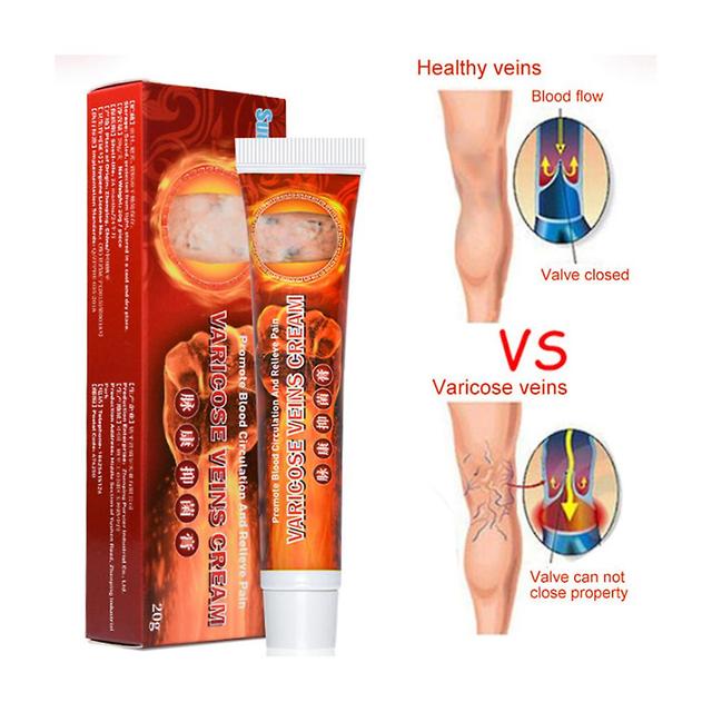 2024 News Varicose Veins Cream Spider Veins Varicosity Angiitis Ointment on Productcaster.