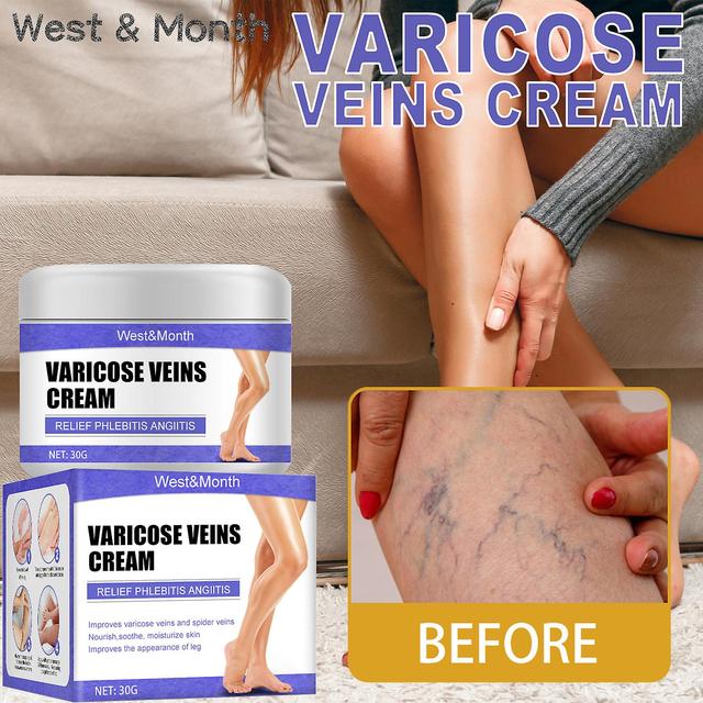 Leg vein repair cream, vein cream, leg varicose veins, bulging leg veins, pain, pulse health care Massage Oil1PCS) 1PCS on Productcaster.